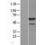 Western Blot: CCT3 Lysate [NBL1-08900] - Western Blot experiments. 
Left-Control; Right -Over-expression Lysate for CCT3